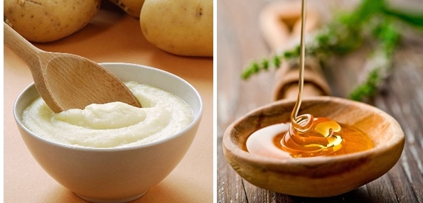 Trị nám tận gốc bằng khoai tây kết hợp mật ong